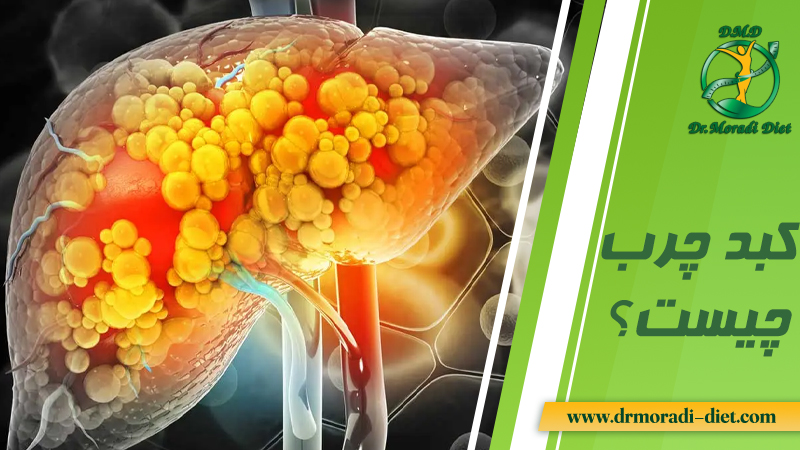 کبد چرب چیست تجزیه و تحلیل از نظر متخصص تغذیه