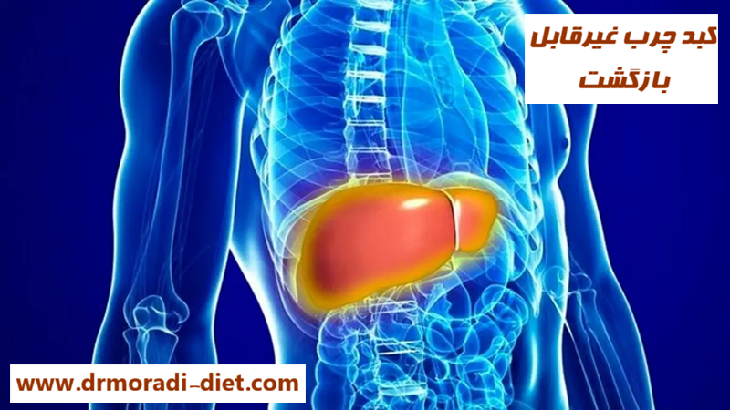 کبدچرب بی بازگشت از نظر متخصص تغذیه