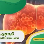 کبدچرب عوامل ایجاد و راه های درمان