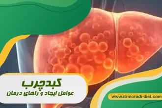 کبدچرب عوامل ایجاد و راه های درمان