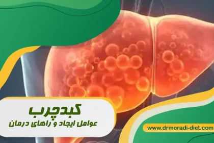 کبدچرب عوامل ایجاد و راه های درمان