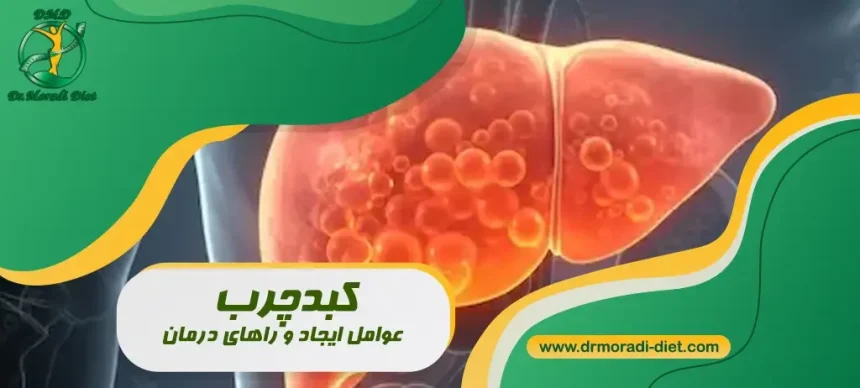 کبدچرب عوامل ایجاد و راه های درمان