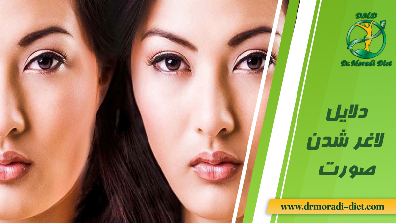 دلایل لاغر شدن صورت از نظر دکتر تغذیه