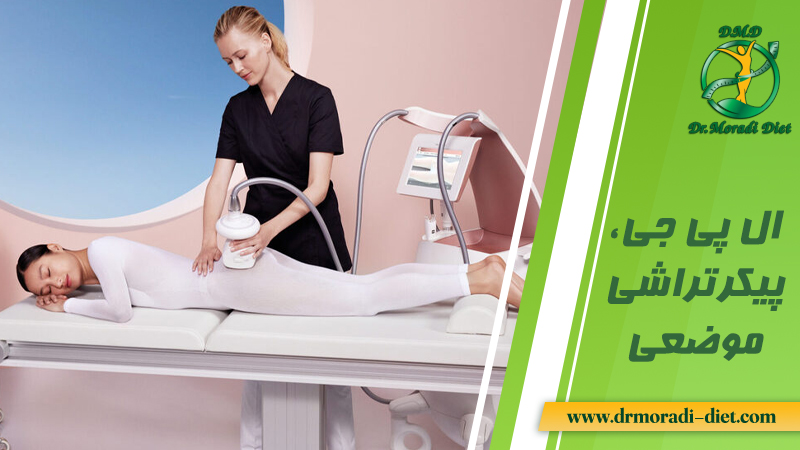 ال پی جی پیکرتراشی موضعی دکتر و متخصص تغذیه