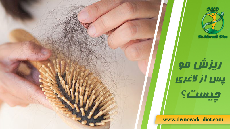 ریزش مو پس از لاغری چیست؟ با مشورت دکتر تغذیه