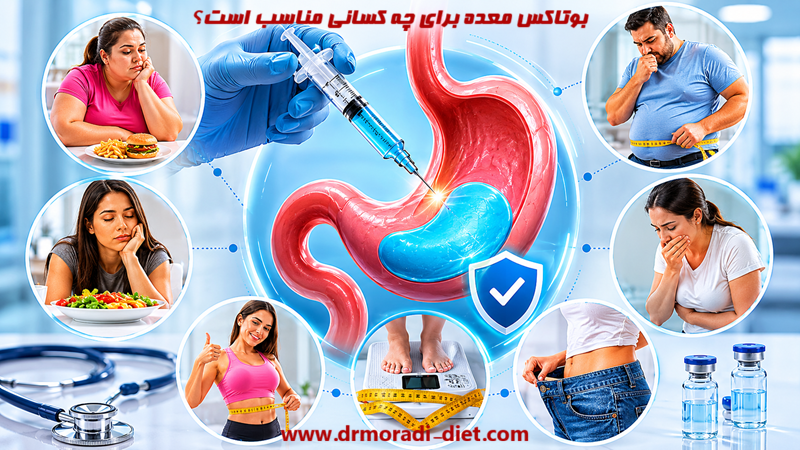 بوتاکس معده برای چه کسانی مناسب است؟ از نظر متخصص تغذیه