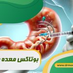 بوتاکس معده چیست؟ با مشورت متخصص تغذیه