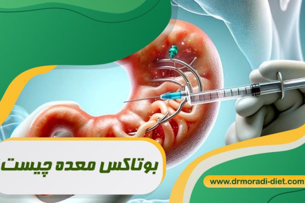 بوتاکس معده چیست؟ با مشورت متخصص تغذیه