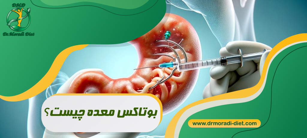بوتاکس معده چیست و چگونه باعث لاغری می‌شود؟