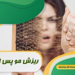 ریزش مو پس از لاغری تحت نظر متخصص تغذیه دکتر مرادی