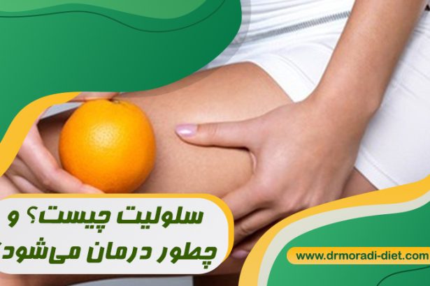 سلولیت چیست و چطور درمان می‌شود؟ با مشورت متخصص تغذیه دکتر مرادی