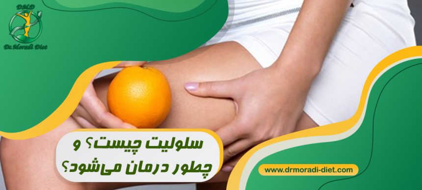 سلولیت چیست و چطور درمان می‌شود؟ با مشورت متخصص تغذیه دکتر مرادی