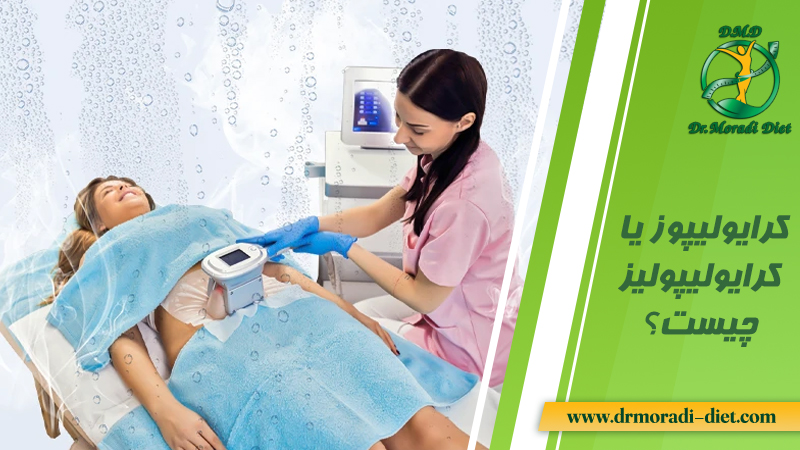 کرایولیپوز یا کرایولیپولیز چیست؟ با مشورت متخصص تغذیه