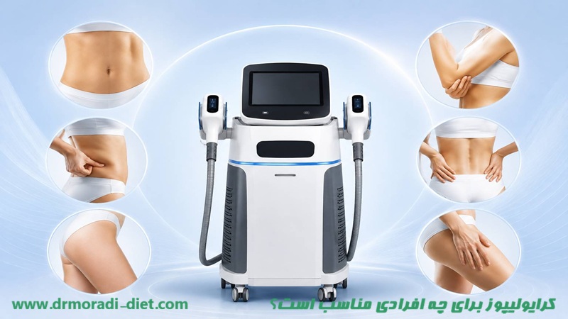 کرایولیپوز برای چه افرادی مناسب است؟ از نظر متخصص تغذیه