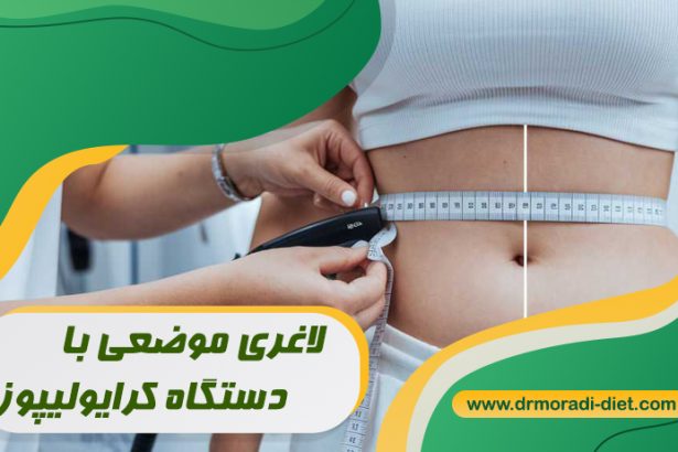 لاغری موضعی با دستگاه کرایولیپوز با مشورت متخصص تغذیه