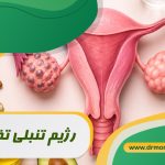رژیم تنبلی تخمدان با مشورت متخصص تغذیه