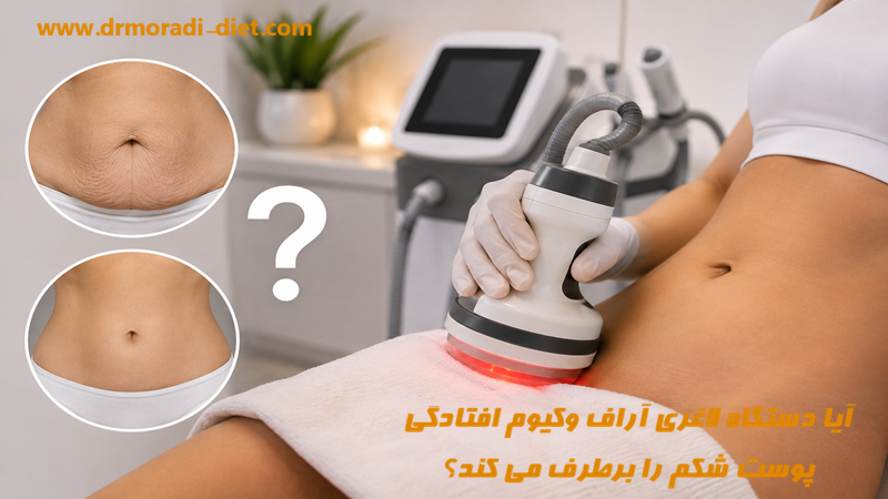 آیا دستگاه لاغری آراف وکیوم افتادگی پوست شکم را برطرف می کند؟ با مشورت متخصص دکتر تغذیه دکتر مرادی