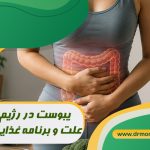 یبوست در رژیم لاغری؛ علت و برنامه غذایی مناسب تحت نظر بهترین متخصص تغذیه