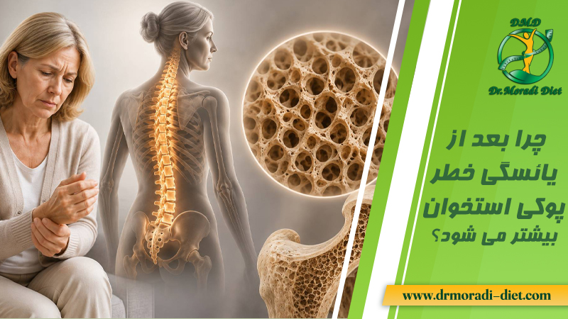 چرا بعد از یائسگی خطر پوکی استخوان بیشتر می‌ شود؟ با مشورت متخصص تغذیه