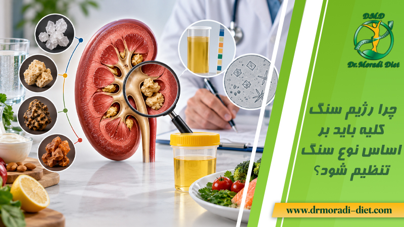 چرا رژیم سنگ کلیه باید بر اساس نوع سنگ تنظیم شود؟ با نظر متخصص تغذیه