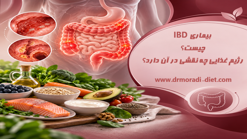 بیماری IBD چیست؟ رژیم غذایی چه نقشی در آن دارد؟ با مشورت متخصص تغذیه