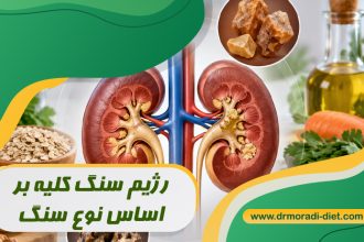 رژیم سنگ کلیه بر اساس نوع سنگ با مشورت دکتر تغذیه