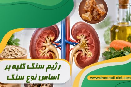 رژیم سنگ کلیه بر اساس نوع سنگ با مشورت دکتر تغذیه