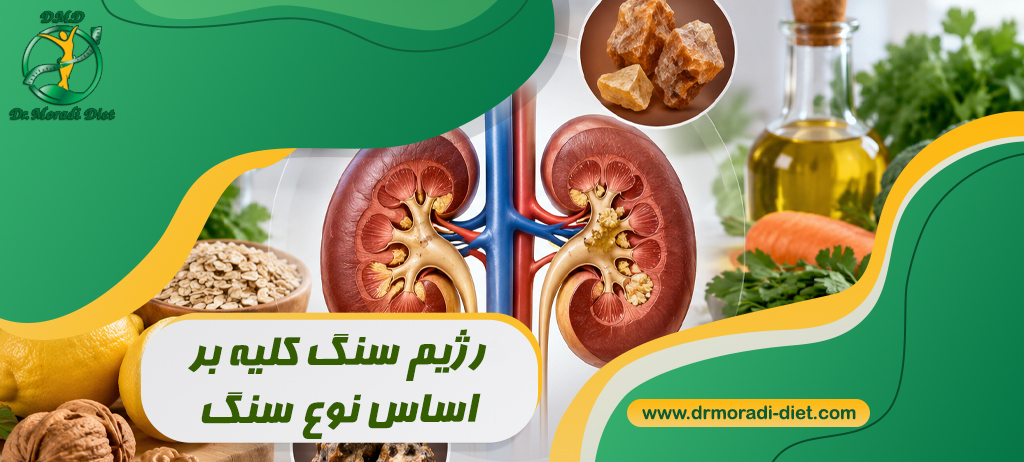 رژیم سنگ کلیه بر اساس نوع سنگ؛ برای سنگ کلیه چه بخوریم و چه نخوریم؟