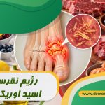 رژیم نقرس و اسید اوریک بالا با مشورت متخصص تغذیه