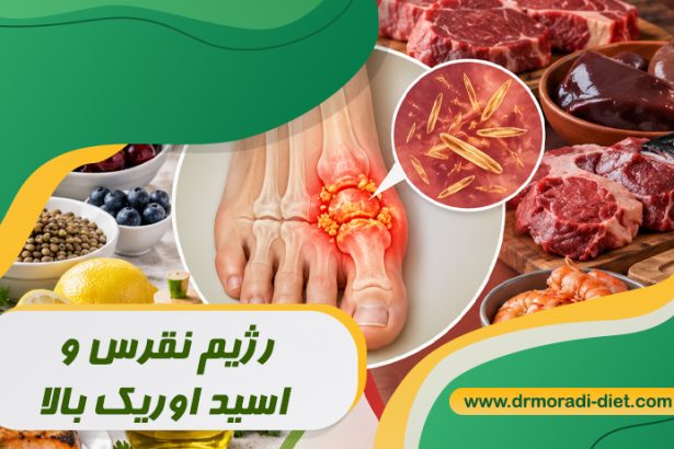 رژیم نقرس و اسید اوریک بالا با مشورت متخصص تغذیه