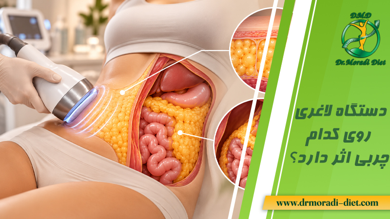 دستگاه لاغری روی کدام چربی اثر دارد؟ از نظر متخصص تغذیه