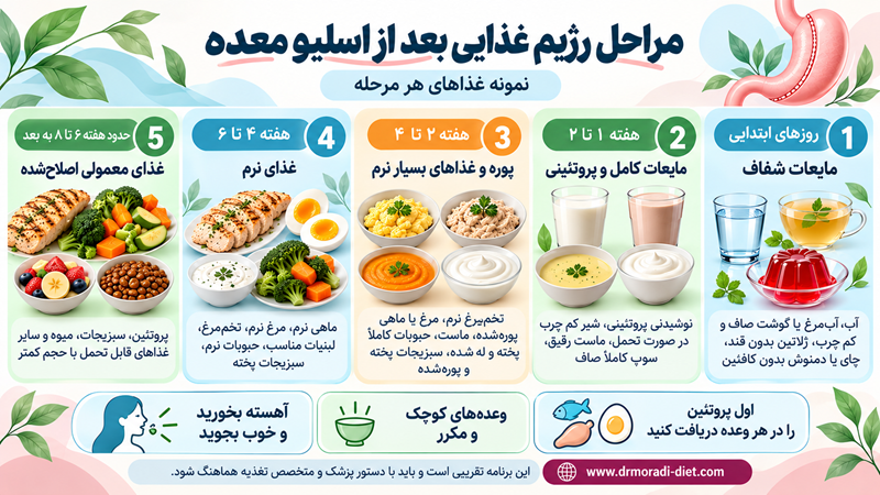 مراحل رژیم غذایی بعد از اسلیو معده با مشورت متخصص تغذیه