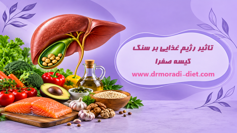 تاثیر رژیم غذایی بر سنگ کیسه صفرا با مشورت متخصص تغذیه