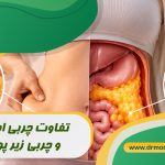 تفاوت چربی احشایی و چربی زیر پوستی با مشورت متخصص تغذیه