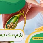 رژیم سنگ کیسه صفرا تحت نظر بهترین متخصص تغذیه