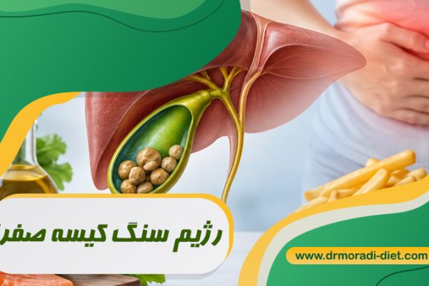 رژیم سنگ کیسه صفرا تحت نظر بهترین متخصص تغذیه