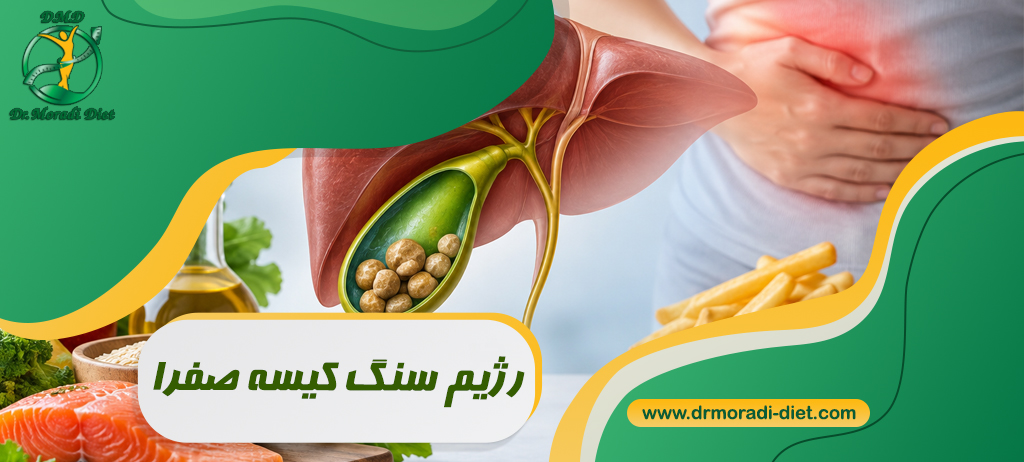 رژیم سنگ کیسه صفرا تحت نظر بهترین متخصص تغذیه