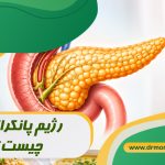 رژیم پانکراتیت چیست؟ با مشورت متخصص تغذیه